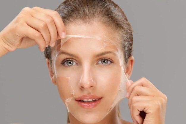 Chemical Peels