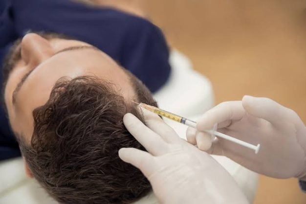 Exosome Hair Therapy