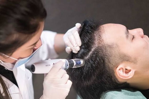Hair Mesotherapy