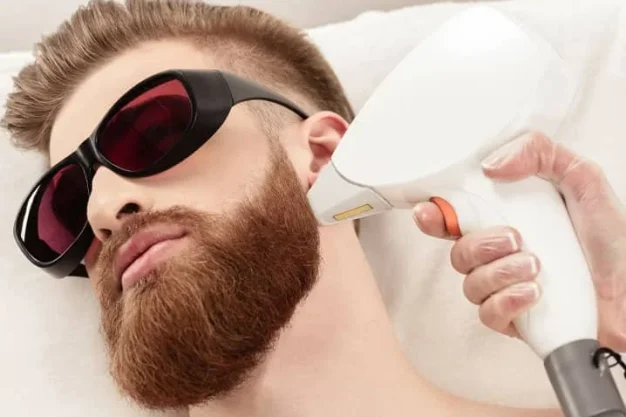 Laser Beard Shaping