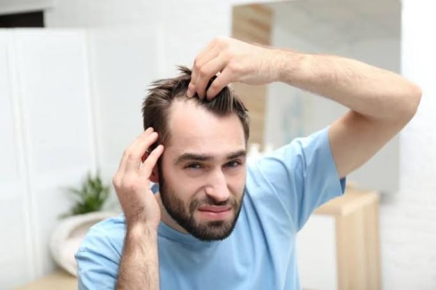 Male Pattern Hair Loss